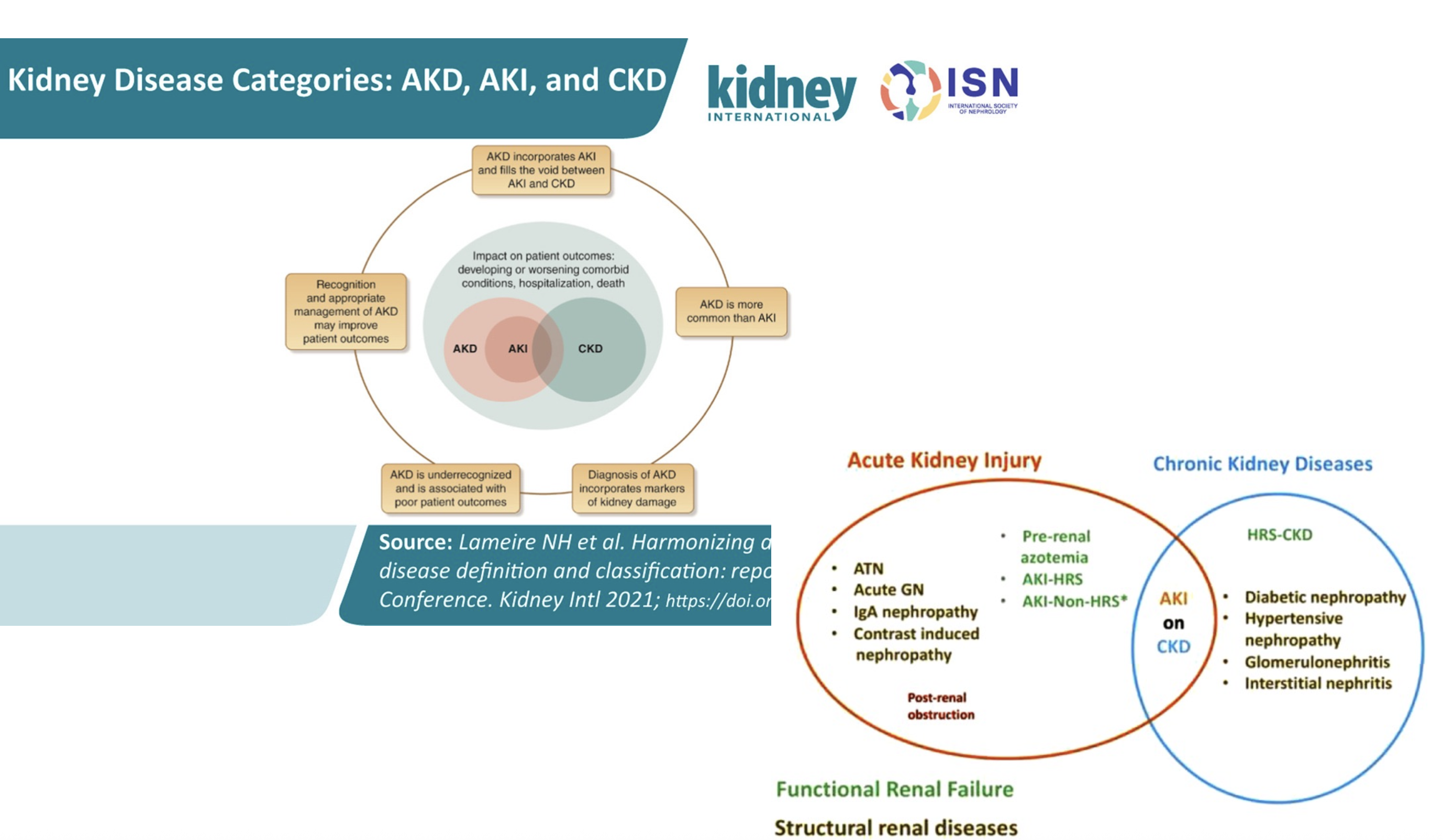 Existing course diagram: AKI is within the broader category of acute kidney disease; AKI and CKD overlap as AKI on CKD.
