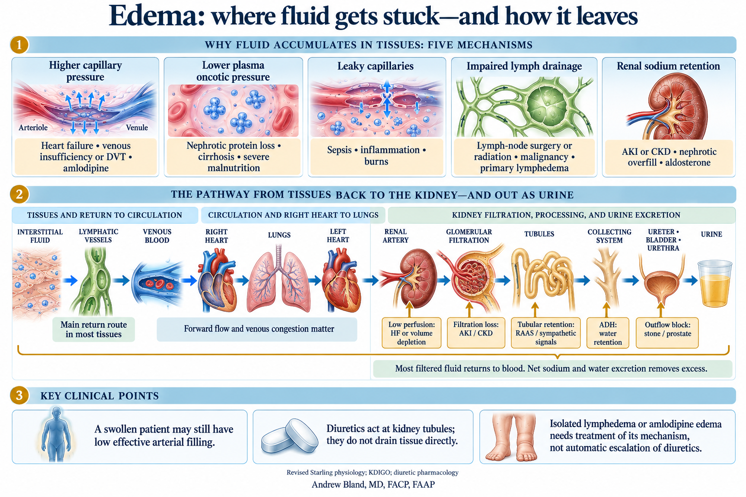 Where edema comes from and how fluid leaves