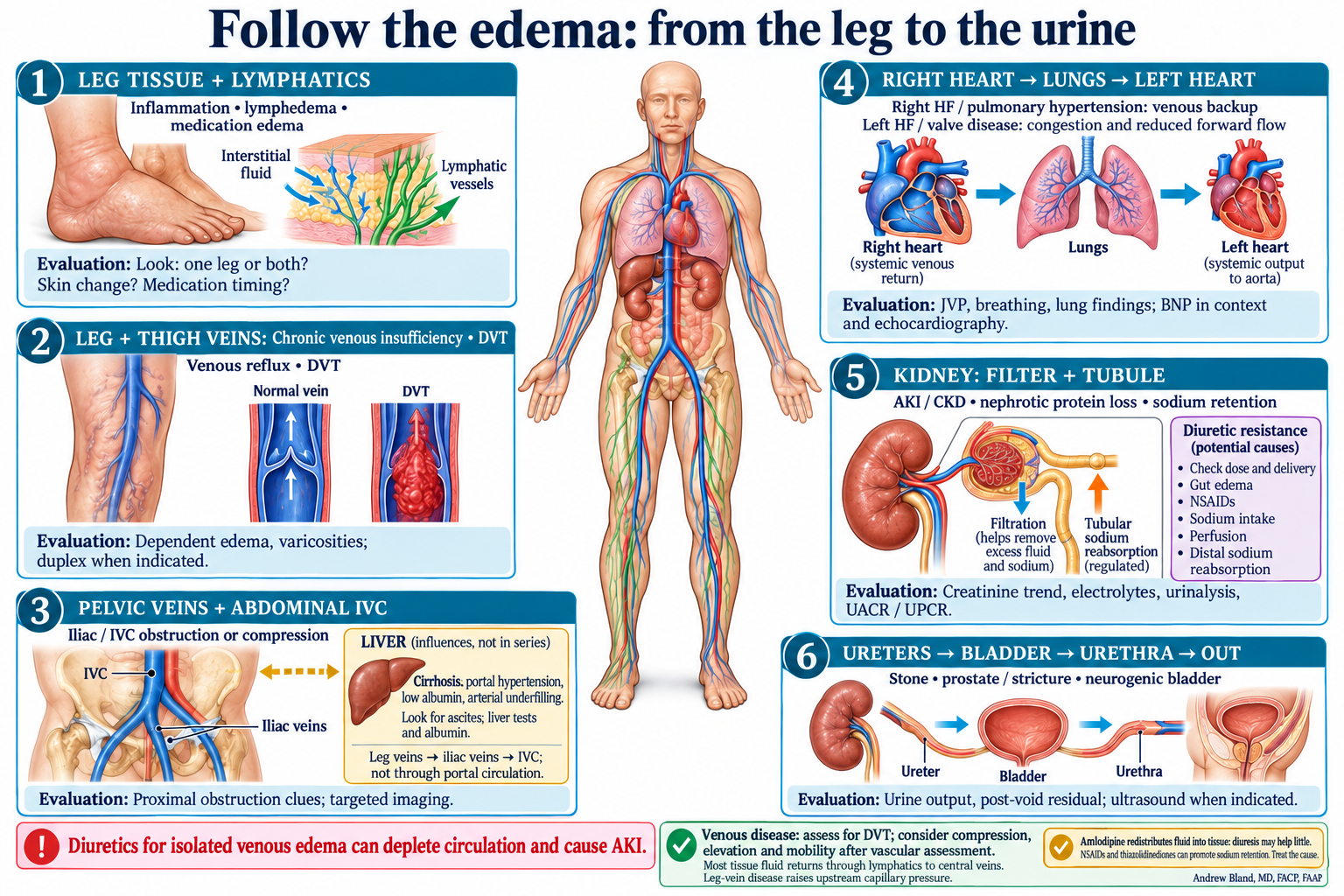 Follow the edema: from the leg to the urine