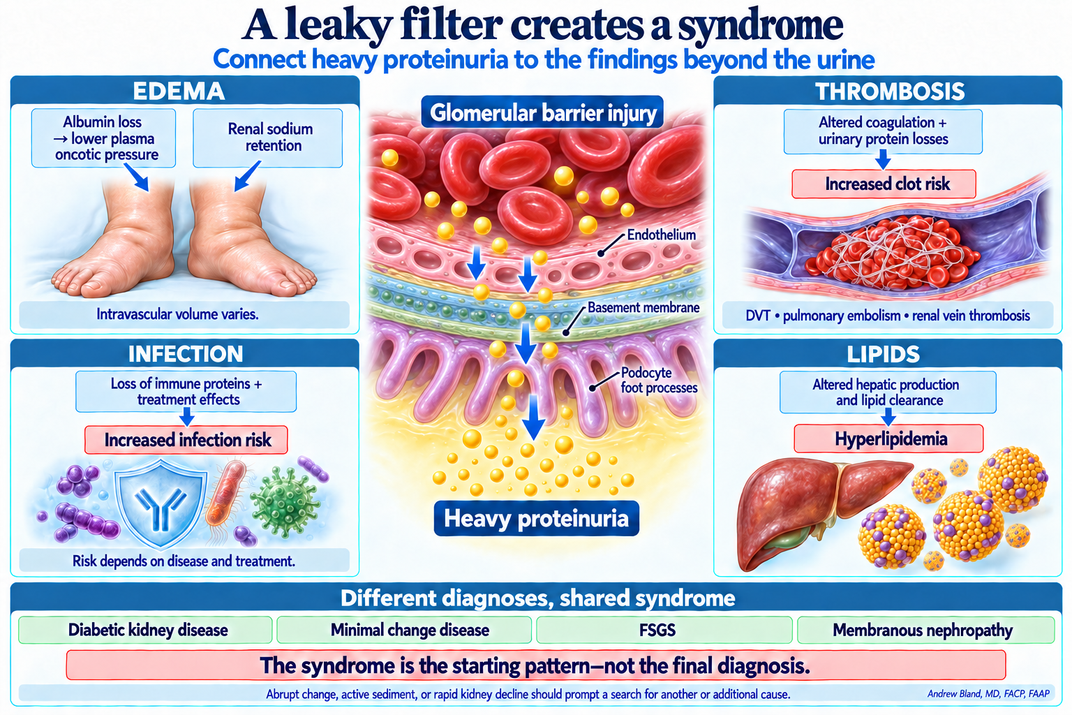 Glomerular barrier injury permits protein loss into urine. Albumin loss and renal sodium retention contribute to edema. Altered coagulation and urinary protein losses increase thrombosis risk; immune protein losses and treatment affect infection risk. Altered hepatic production and lipid clearance cause hyperlipidemia.