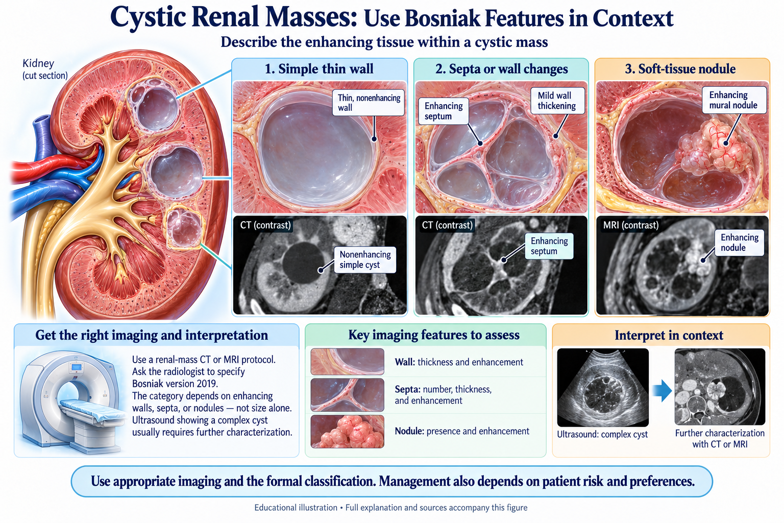 Cystic Renal Masses: Use Bosniak Features in Context visual summary. Open for the full image and text version.