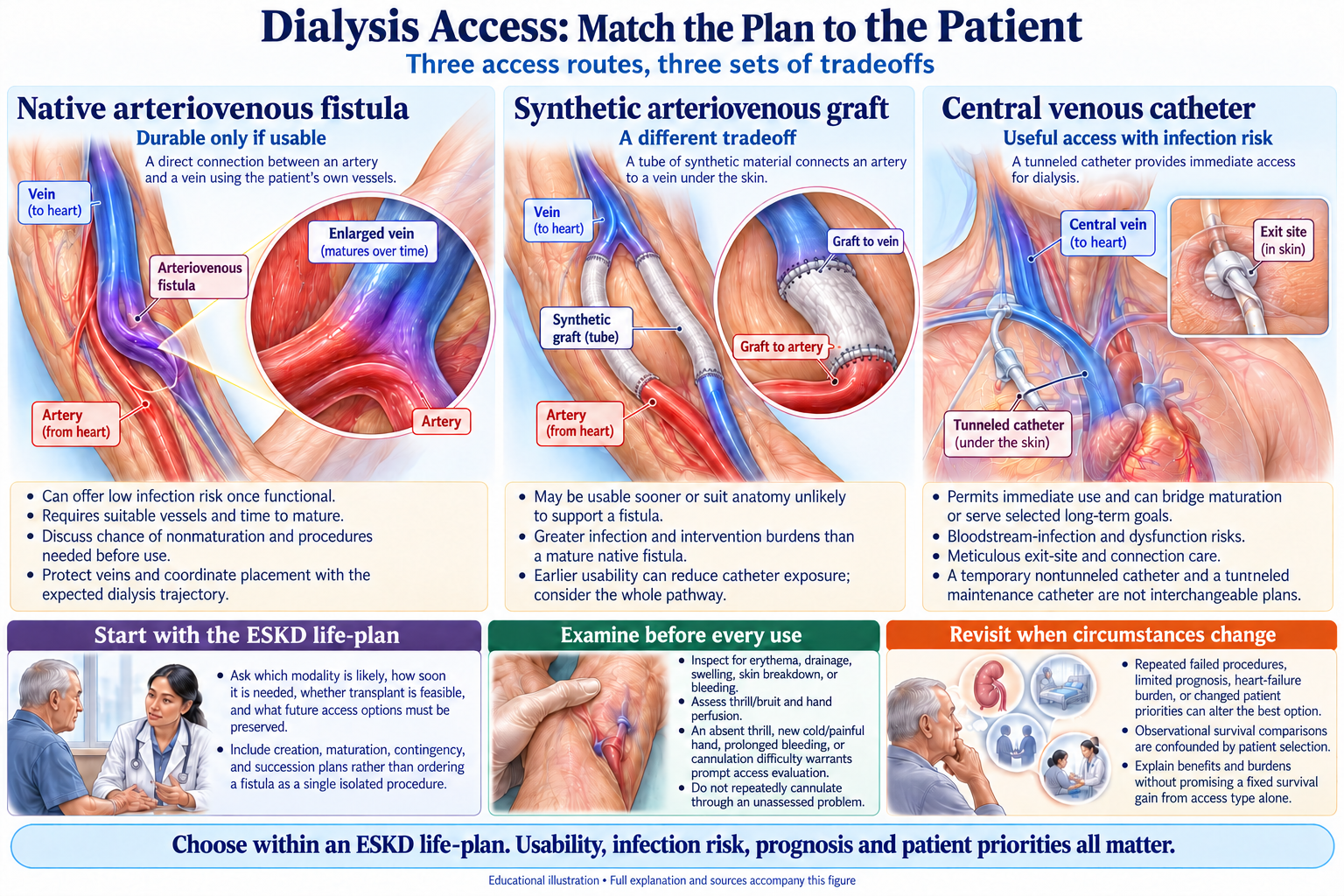 Dialysis Access: Match the Plan to the Patient visual summary