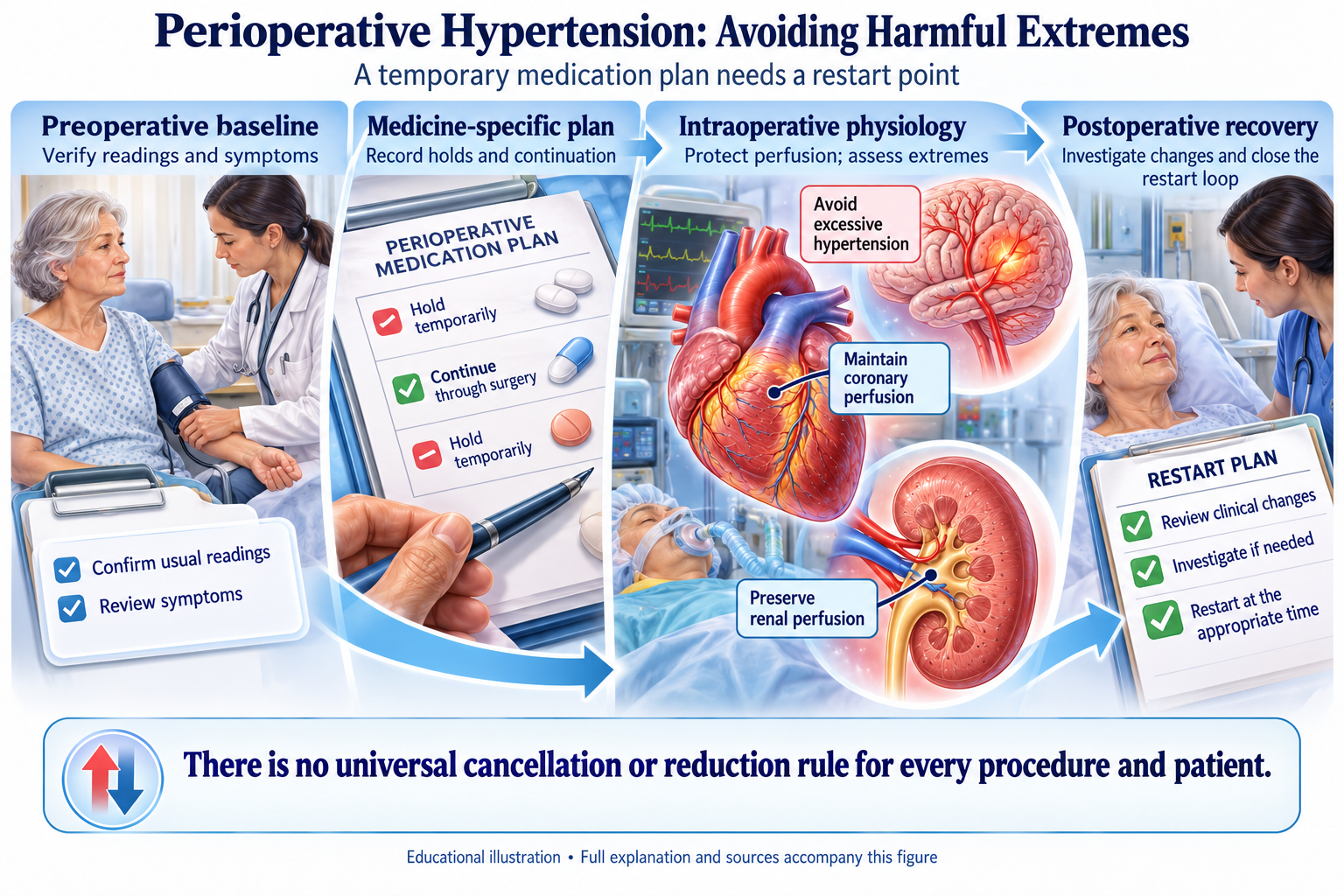 Perioperative Hypertension: Avoiding Harmful Extremes visual summary