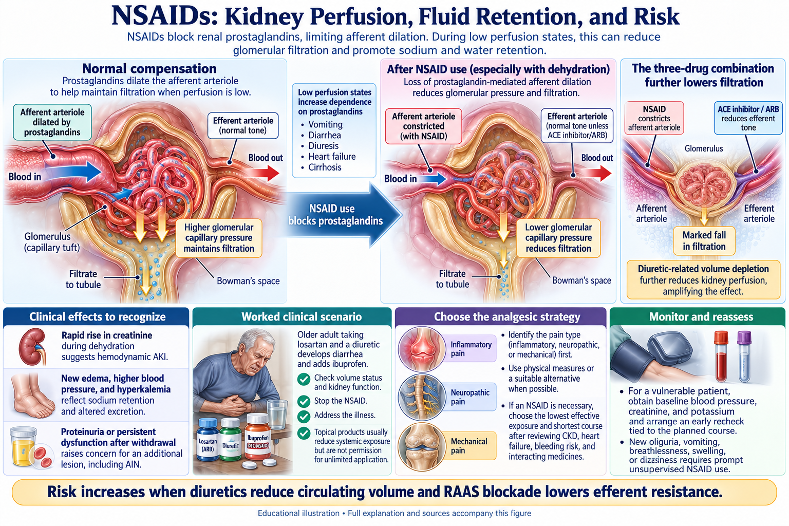 NSAIDs: Kidney Perfusion, Fluid Retention, and Risk visual summary