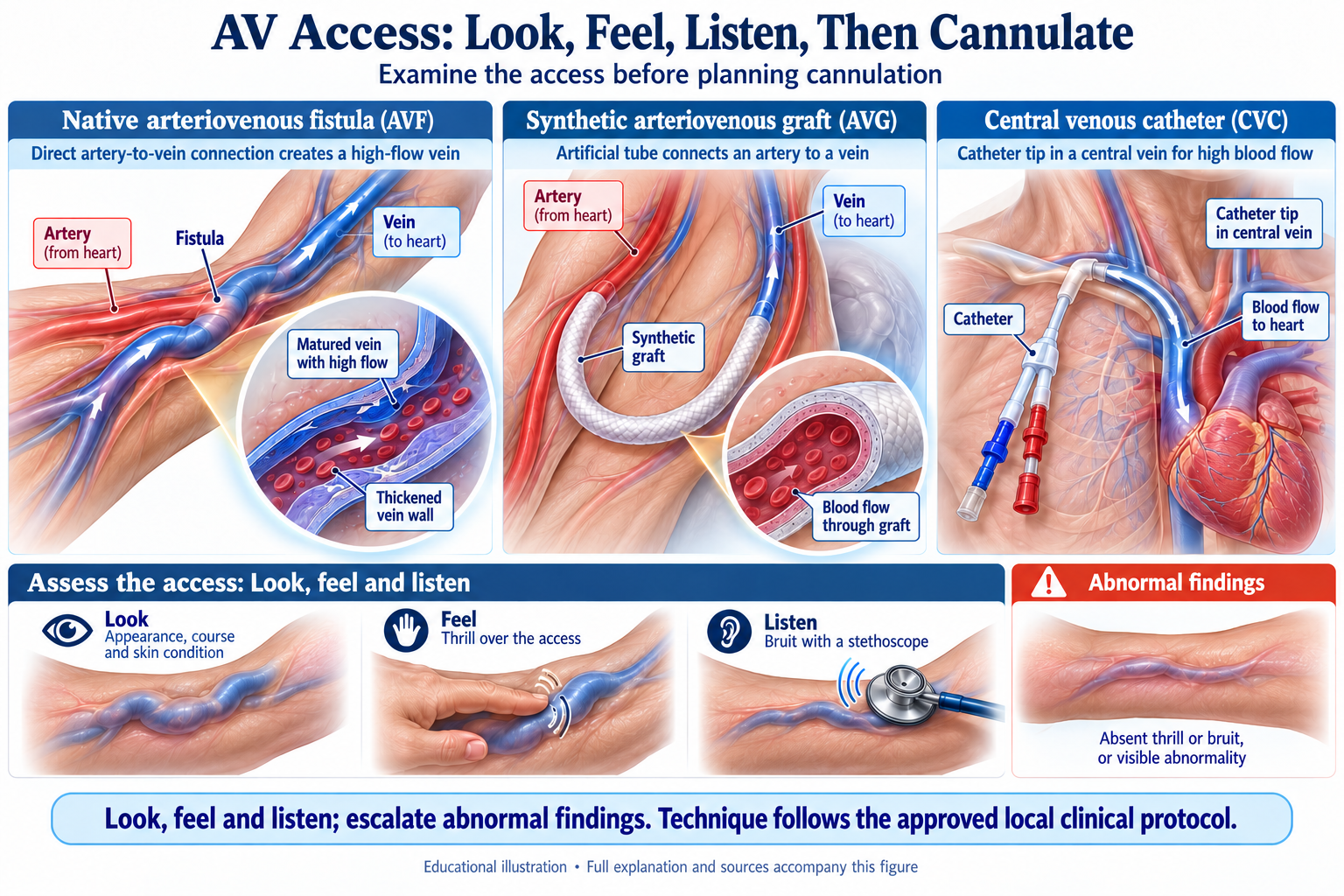 N7 · Access Assessment and Cannulation visual summary