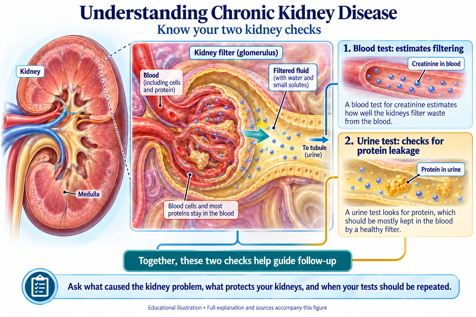 Understanding Chronic Kidney Disease visual summary