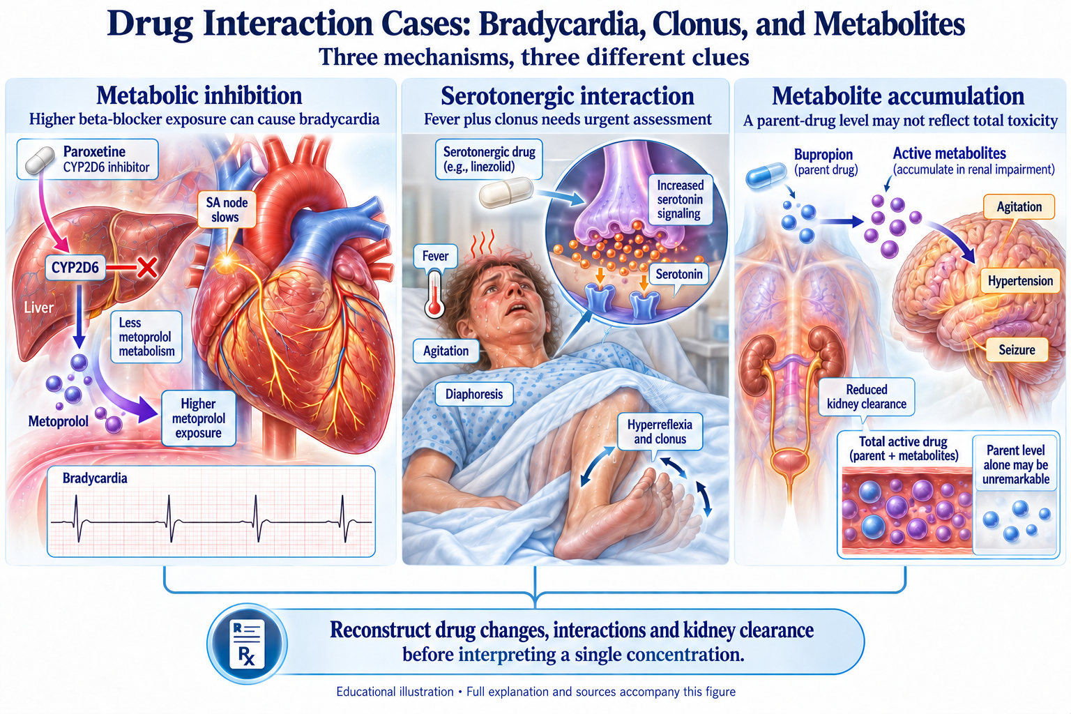 Drug Interaction Cases: Bradycardia, Clonus, and Metabolites visual summary