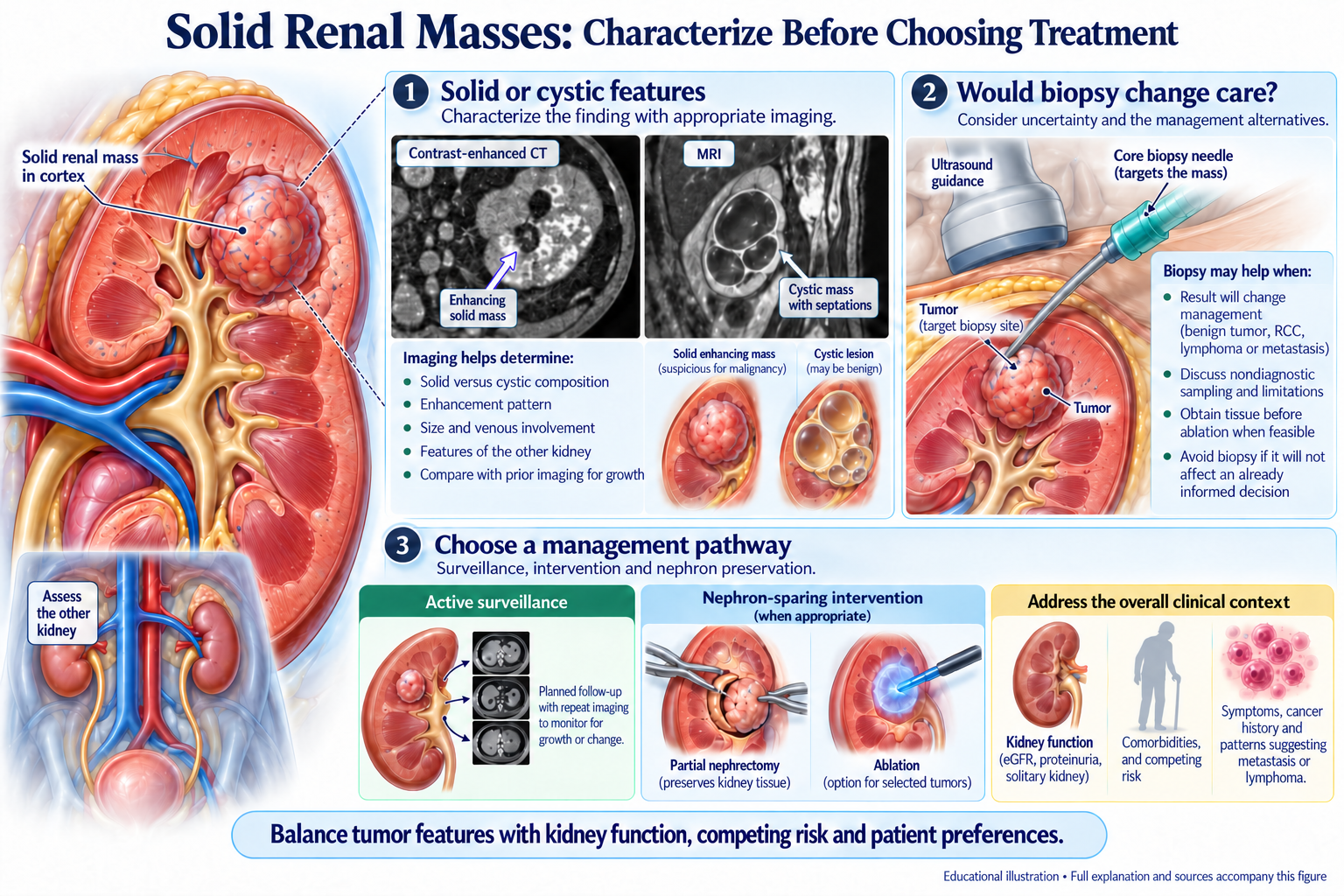 Solid Renal Masses: Characterize Before Choosing Treatment visual summary. Open for the full image and text version.
